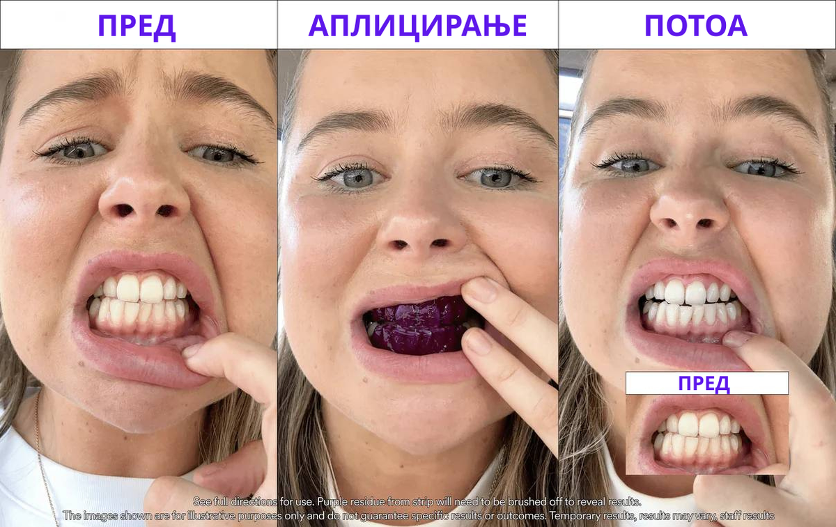 V34 Ленти за избелување заби